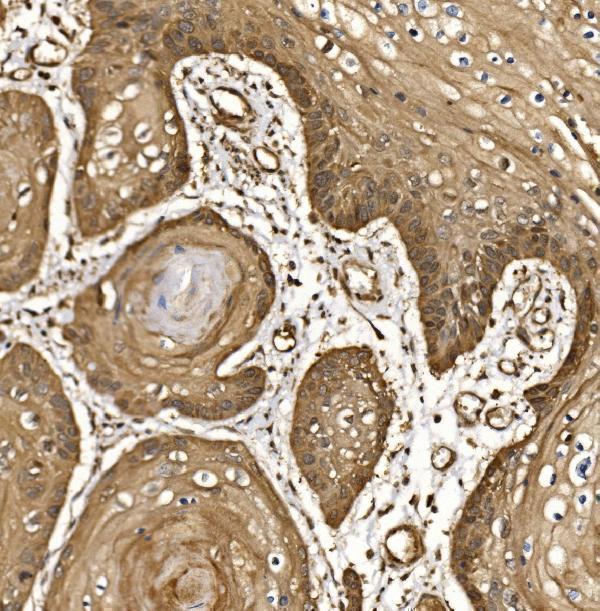  IHC analysis of EIF5 using anti-EIF5 antibody (A04623-2)