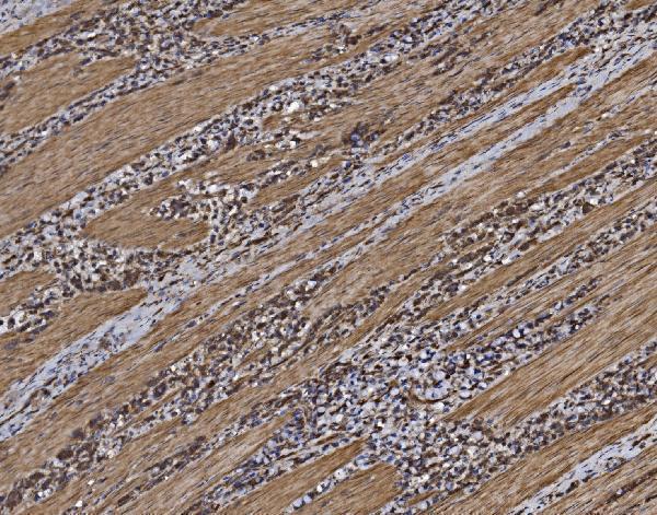  IHC analysis of EIF5 using anti-EIF5 antibody (A04623-2)