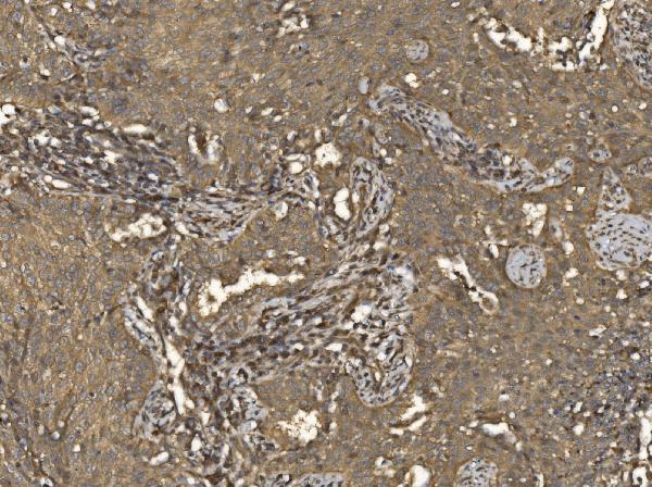 a04623 2 eif5 primary antibodies ihc testing 5