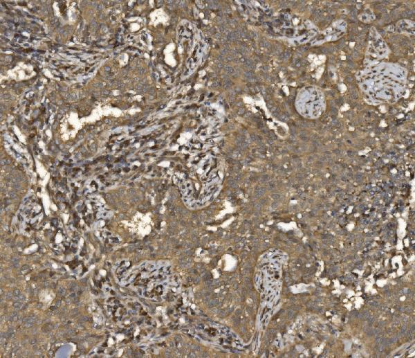 a04623 2 eif5 primary antibodies ihc testing 6