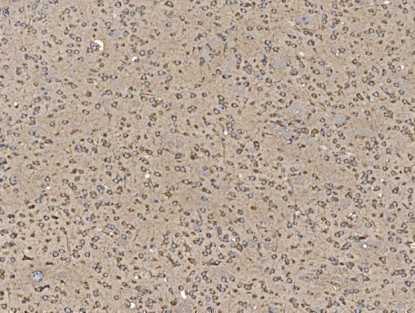 a04623 2 eif5 primary antibodies ihc testing 9