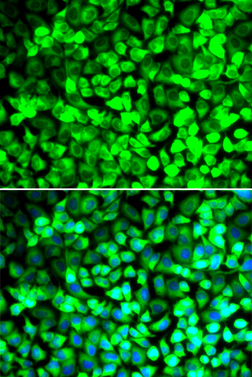 a04623 eif5 primary antiboties if testing 2