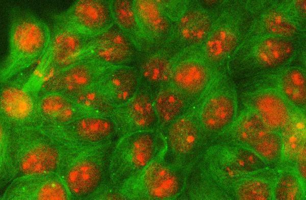 a04625 1 spdef primary antibodies if testing 2