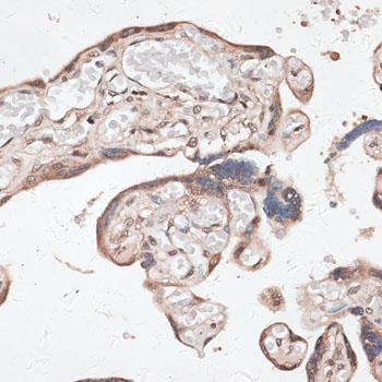 Immunohistochemistry of paraffin-embedded human placenta using SPDEF antibody  at dilution of 1:100 
