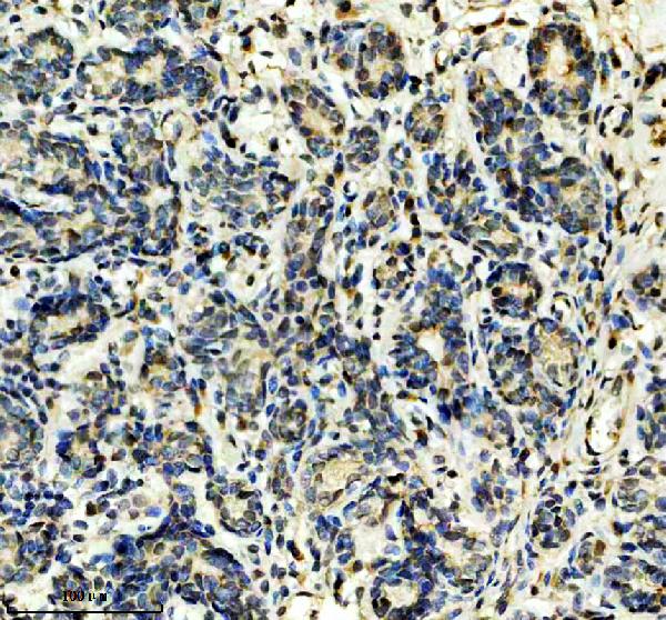 IHC analysis of THOC1 using anti-THOC1 antibody (A04626-2)