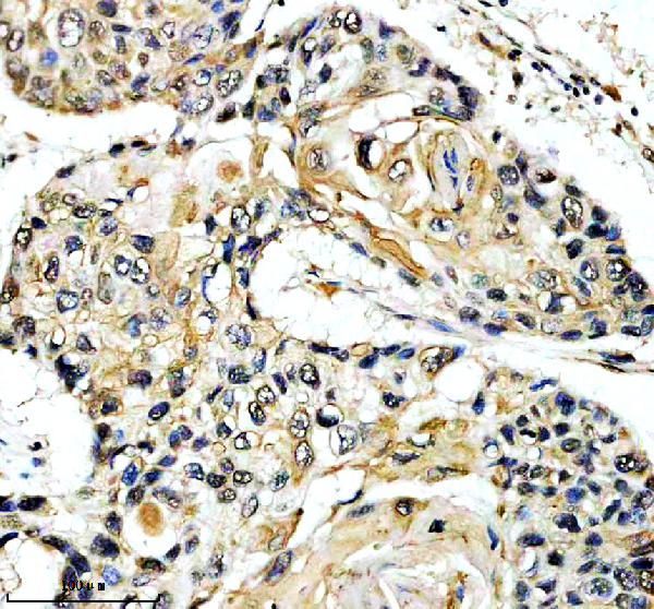 IHC analysis of THOC1 using anti-THOC1 antibody (A04626-2)
