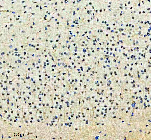 a04626 2 thoc1 primary antibodies ihc testing 3