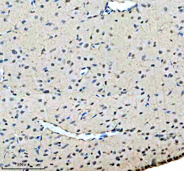 a04626 2 thoc1 primary antibodies ihc testing 4
