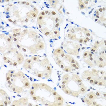 a04626 thoc1 primary antiboties ihc testing 3