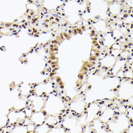 a04626 thoc1 primary antiboties ihc testing 4