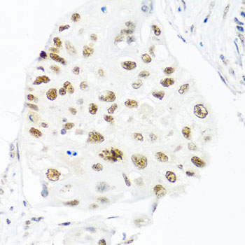 a04626 thoc1 primary antiboties wb testing 2