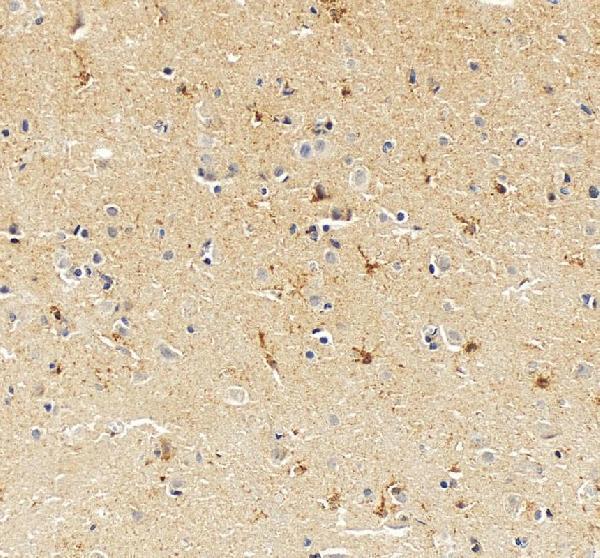 a04629 1 slc12a5 primary antibodies ihc testing 8