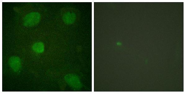 a04630 tgfb1i1 primary antibodies if testing 1