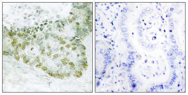 a04630 tgfb1i1 primary antibodies ihc testing 3