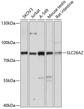 a04631 slc26a2 primary antiboties wb testing 1