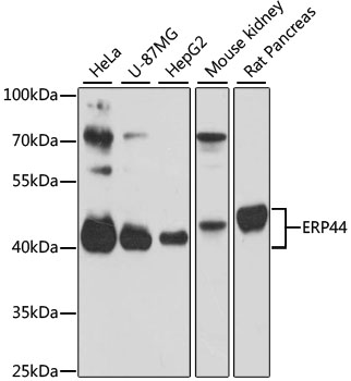 Western blot analysis of extracts of various cell lines, using ERP44 antibody  at 1:3000 dilution
