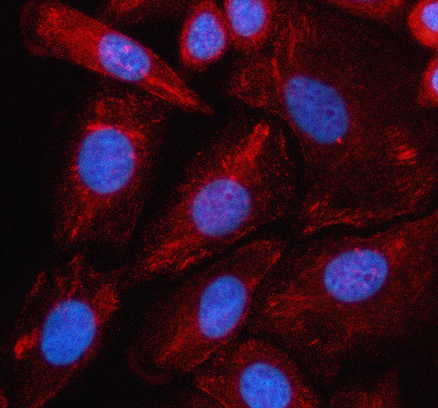 a04633 2 ldb3 primary antibodies if testing 1