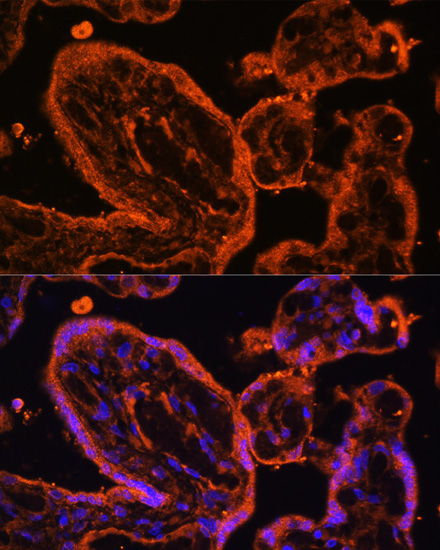 Immunofluorescence analysis of human placenta cells using LDB3 antibody  at dilution of 1:100