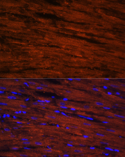 Immunofluorescence analysis of rat heart cells using LDB3 antibody  at dilution of 1:100