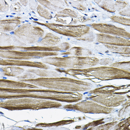 a04633 ldb3 primary antiboties ihc testing 2