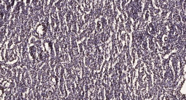 Immunohistochemical analysis of paraffin-embedded human brain tumor