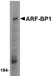 a04634 huwe1 primary antibodies wb testing 1