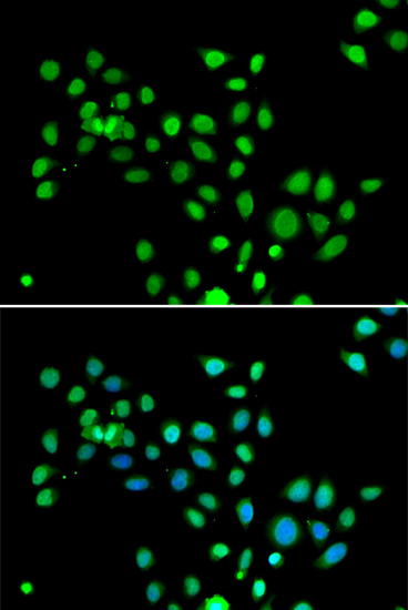 a04635 1 h2afy primary antiboties if testing 3