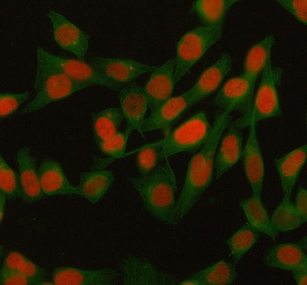Figure 1: Monoclonal antibodies recognize a specific epitope, whereas polyclonal antibodies recognize multiple epitopes.