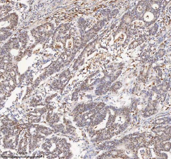a04635 3 h2afy primary antibodies ihc testing 2