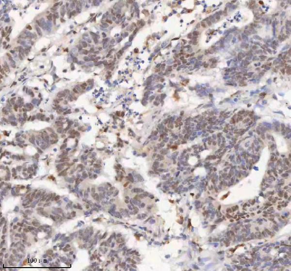 a04635 3 h2afy primary antibodies ihc testing 3