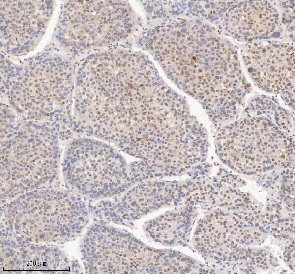 a04635 3 h2afy primary antibodies ihc testing 4