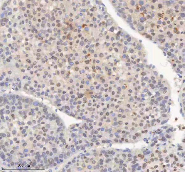 a04635 3 h2afy primary antibodies ihc testing 5