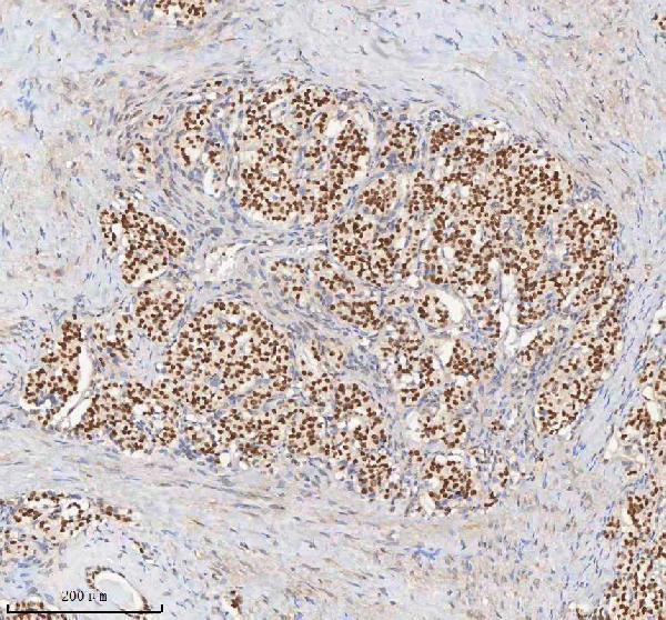 a04635 3 h2afy primary antibodies ihc testing 6