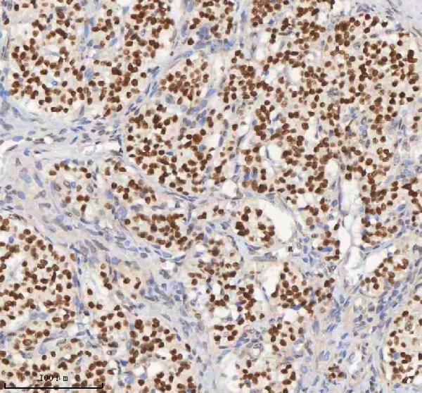 a04635 3 h2afy primary antibodies ihc testing 7