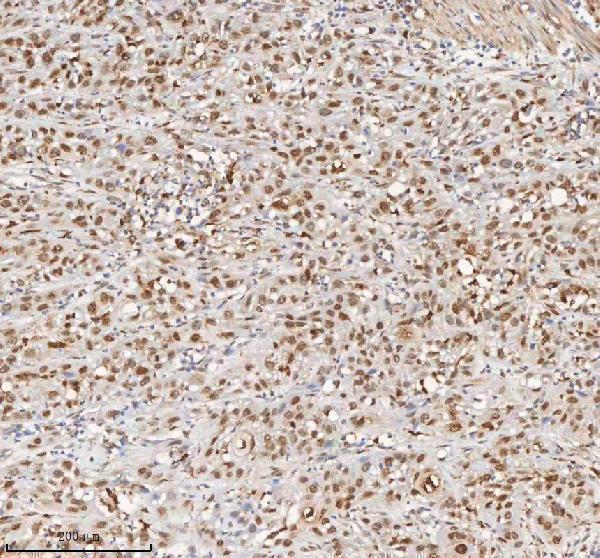 a04635 3 h2afy primary antibodies ihc testing 8