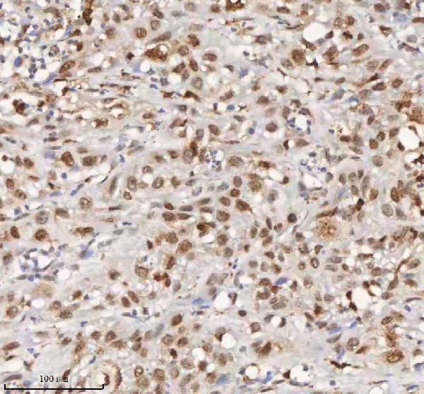 a04635 3 h2afy primary antibodies ihc testing 9