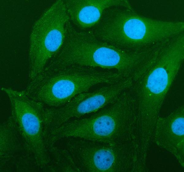 IF analysis of PSME1 using anti-PSME1 antibody (A04638-2)