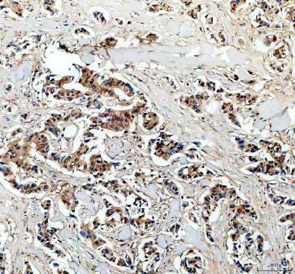 IHC analysis of PSME1 using anti-PSME1 antibody (A04638-2)