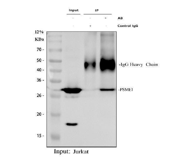 a04638 2 psme1 primary antibodies ip testing 1
