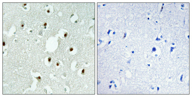 Immunohistochemical analysis of paraffin-embedded Human brain