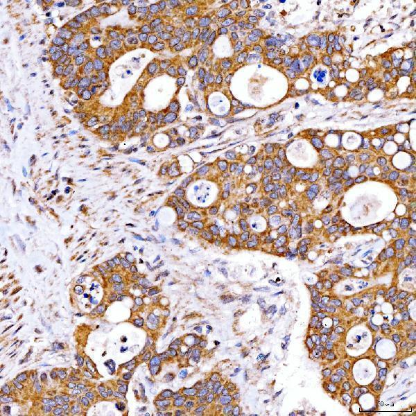  IHC analysis of Rab4/RAB4A using anti-Rab4/RAB4A antibody (A04643-2)