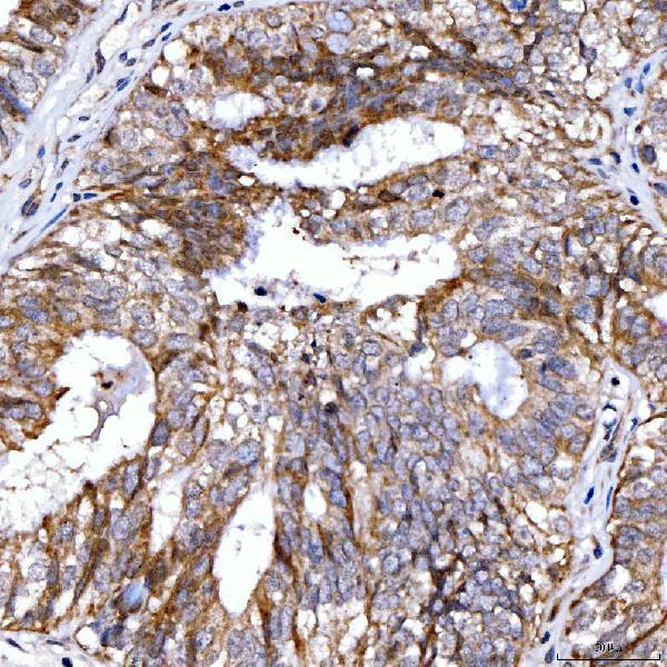  IHC analysis of Rab4/RAB4A using anti-Rab4/RAB4A antibody (A04643-2)
