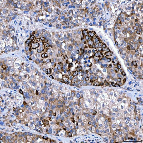 a04643 2 rab4a primary antibodies ihc testing 4