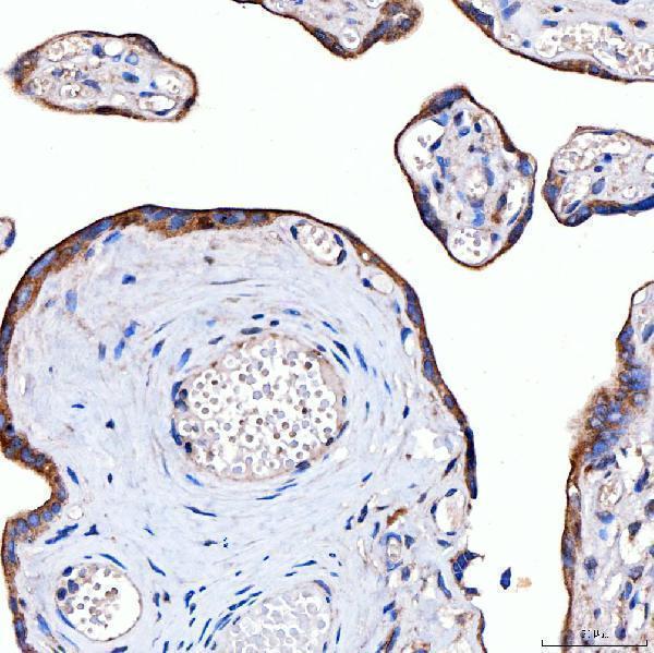 a04643 2 rab4a primary antibodies ihc testing 6