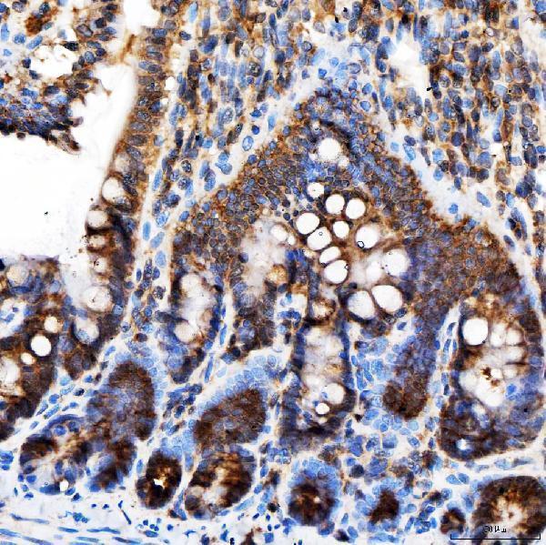 a04643 2 rab4a primary antibodies ihc testing 8