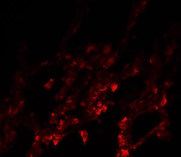Immunofluorescence of NDFIP1 in human lung tissue with NDFIP1 antibody at 20 μg/ml