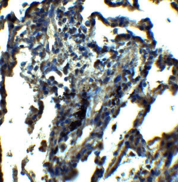 Immunohistochemistry of NDFIP1 in human lung tissue with NDFIP1 antibody at 5 μg/ml