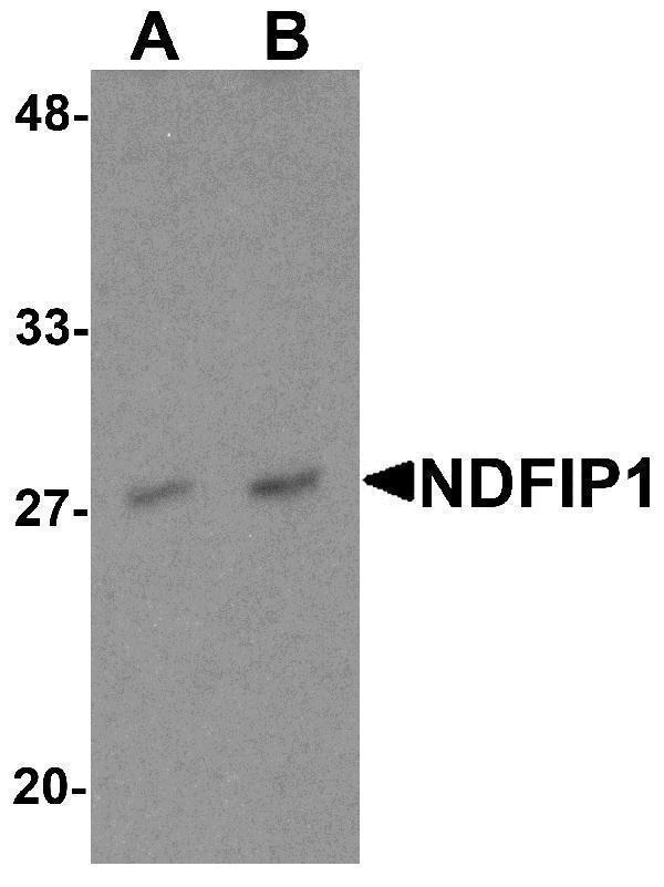 Western blot analysis of NDFIP1 in PC-3 cell lysate with NDFIP1 antibody at (A) 0