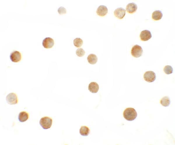 Immunocytochemistry of ZMYM2 in HeLa cells with ZMYM2 antibody at 10 μg/mL