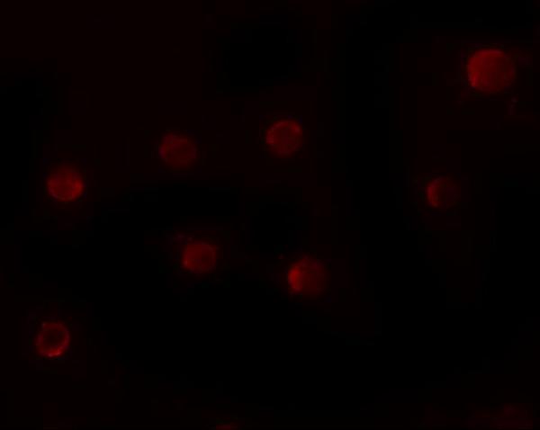 Immunofluorescence of ZMYM2 in HeLa cells with ZMYM2 antibody at 20 μg/mL